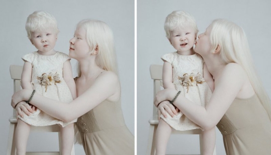 Albino sisters from Kazakhstan conquer the modeling world