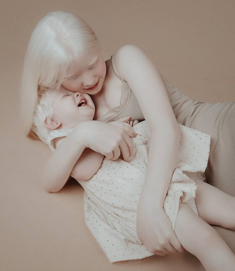 Albino sisters from Kazakhstan conquer the modeling world