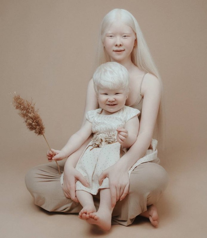 Albino sisters from Kazakhstan conquer the modeling world