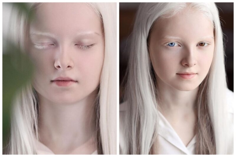 An albino girl from Chechnya struck with her unique appearance