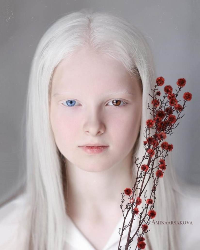 An albino girl from Chechnya struck with her unique appearance