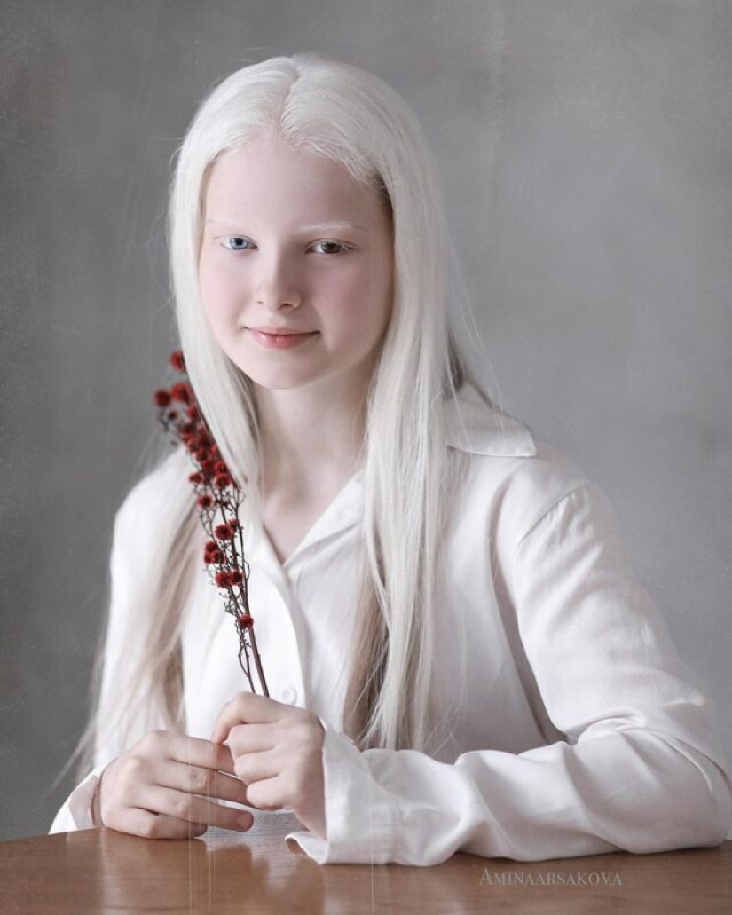 An albino girl from Chechnya struck with her unique appearance