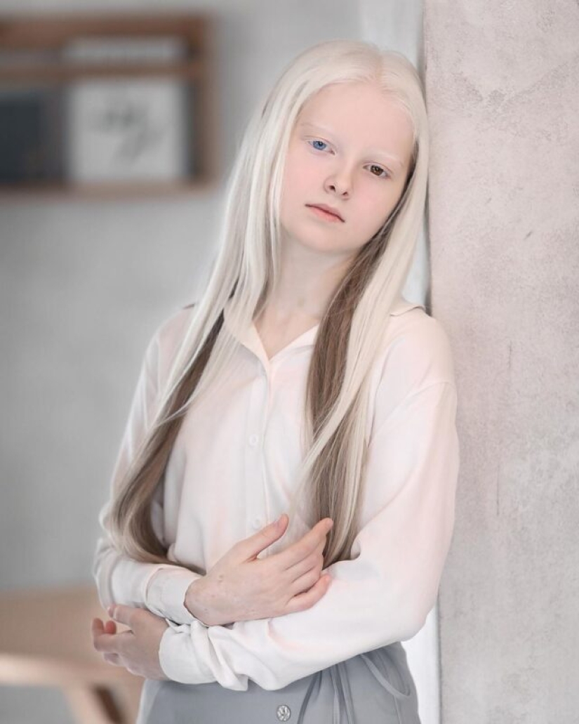 An albino girl from Chechnya struck with her unique appearance