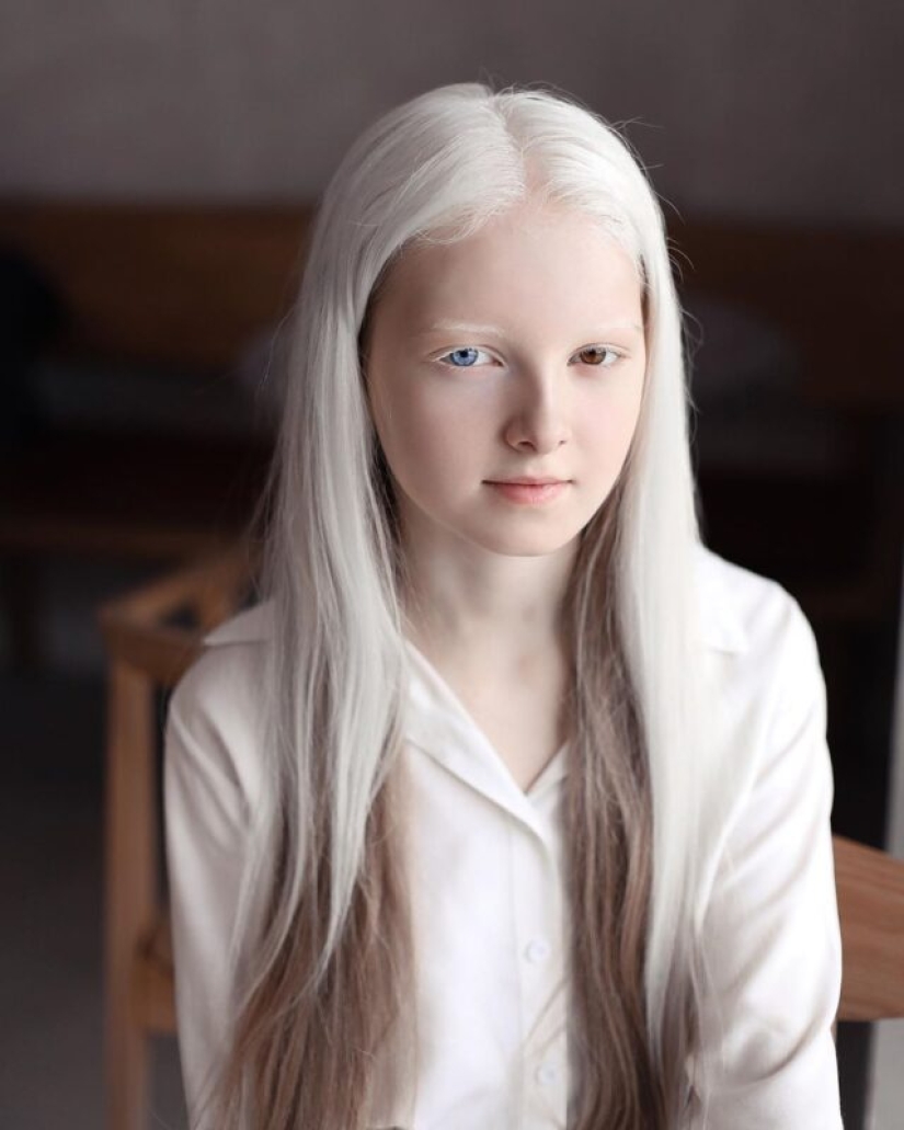 An albino girl from Chechnya struck with her unique appearance