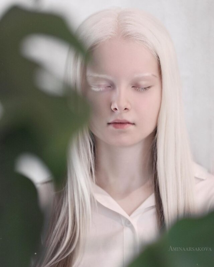 An albino girl from Chechnya struck with her unique appearance