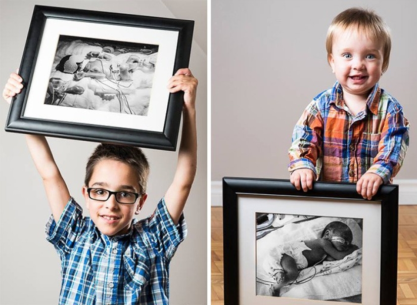 Antes y después: fotos fuertes de niños que nacieron prematuramente
