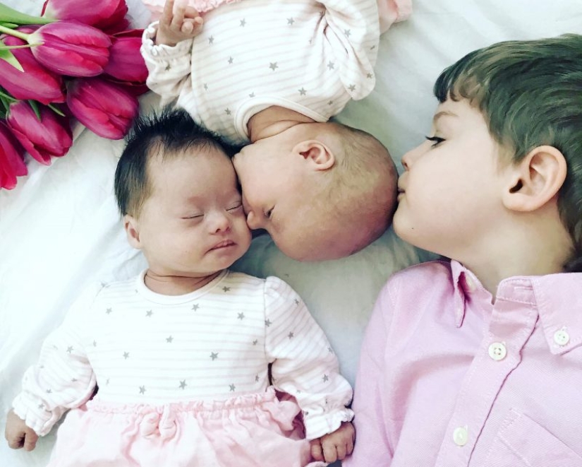 "Babies in a million": a British couple had unique twin girls