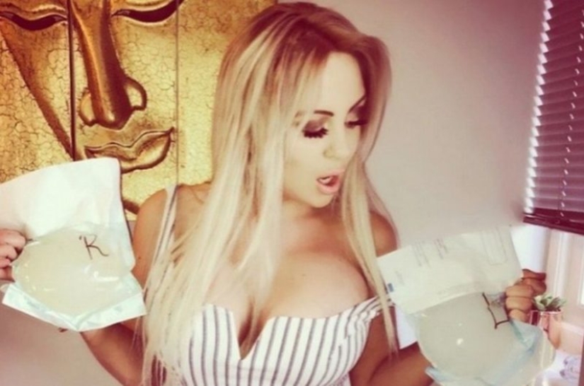 "Balls with a juicy story": to increase the bust, a porn model sells her old implants