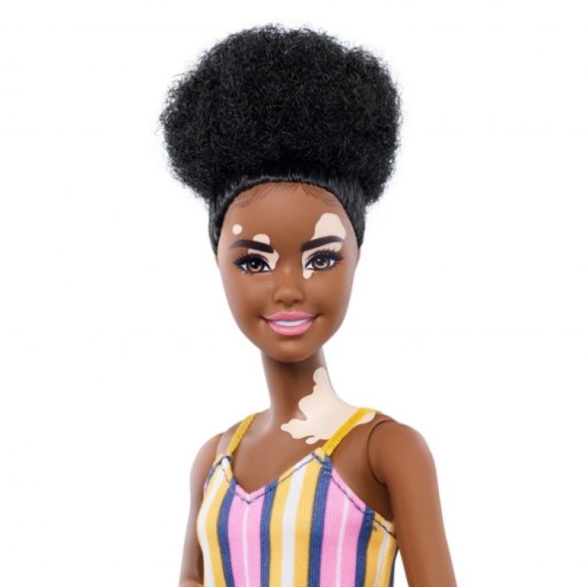 Barbie sin pelo, con vitíligo y prótesis: Mattel lanzará muñecas inclusivas
