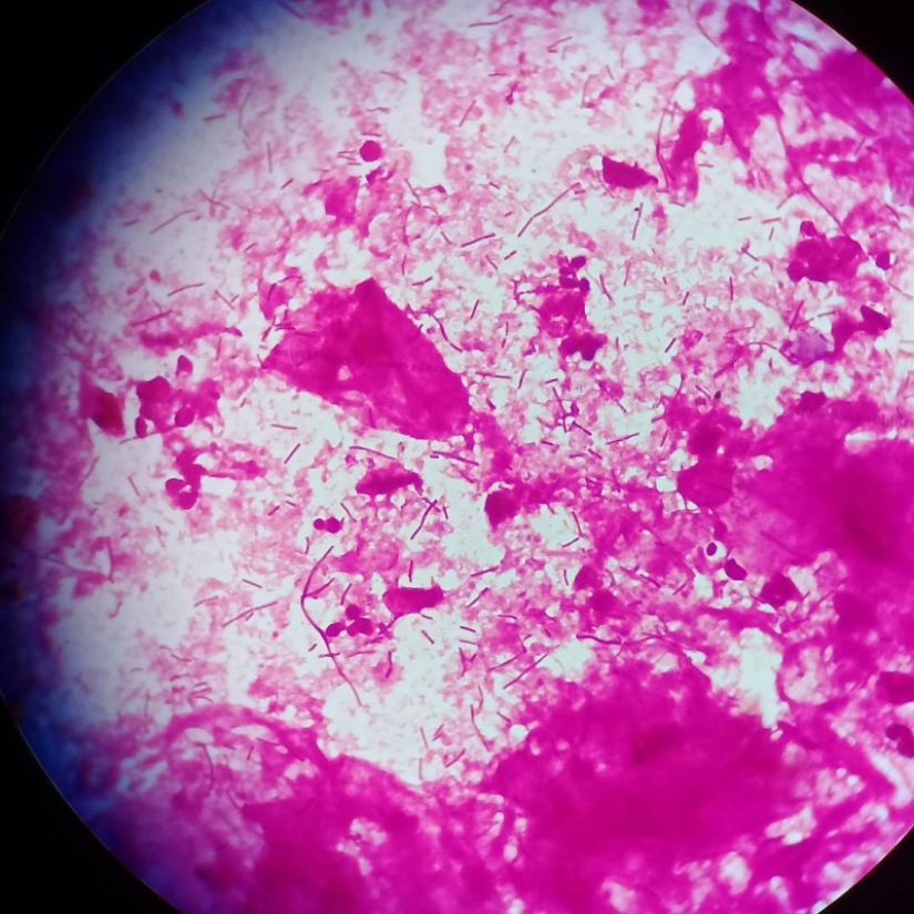 Beauty inside: a microbiologist from Ufa shows on Instagram the viruses and bacteria that live in us