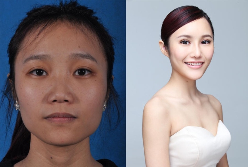 Beauty standards: Chinese women after plastic surgery