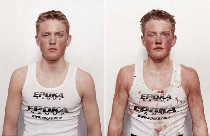 Boxeadores jóvenes: antes y después de la pelea