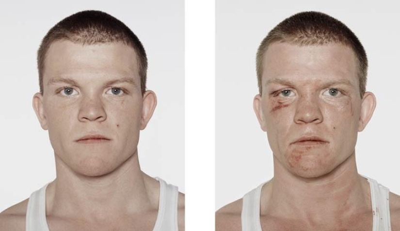 Boxeadores jóvenes: antes y después de la pelea