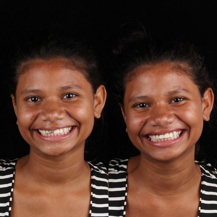 Brazilian dentist helps poor people shine with a snow-white smile