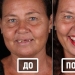 Brazilian dentist helps poor people shine with a snow-white smile