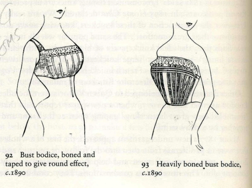 Breast augmentation 100 years ago. How was it?