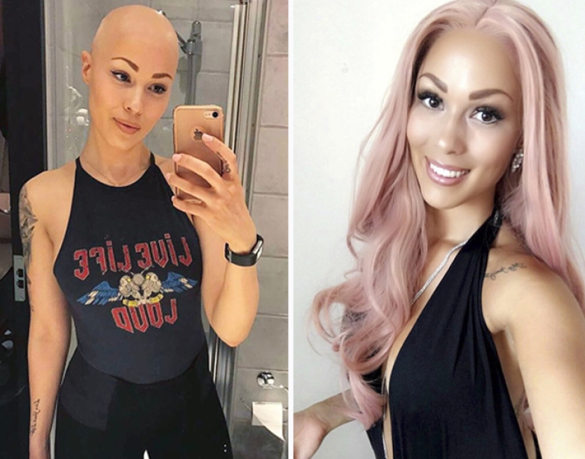 Brilliant: how a bald girl stopped being shy and turned into a star