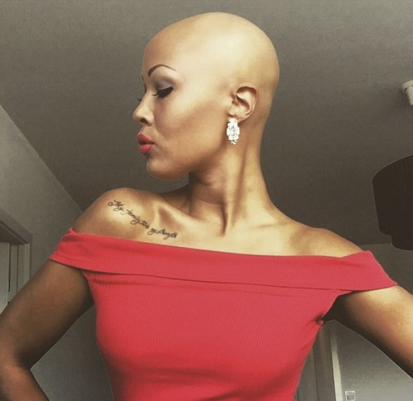Brilliant: how a bald girl stopped being shy and turned into a star