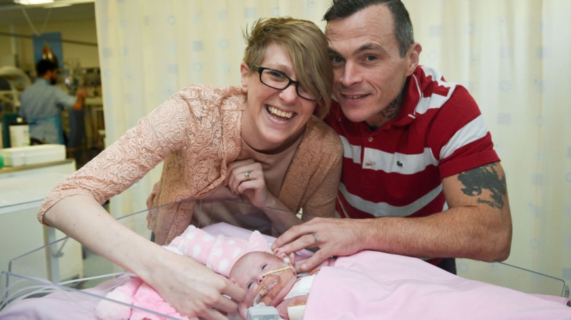 British doctors saved a baby girl who was born with her heart out