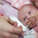 British doctors saved a baby girl who was born with her heart out