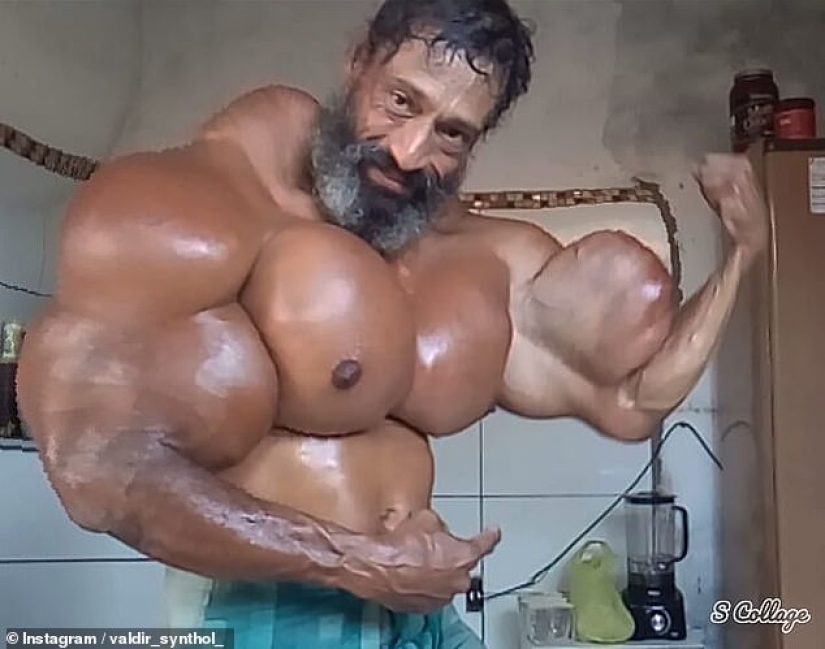 Bulbosaurus from Brazil: former drug addict gives himself oil injections