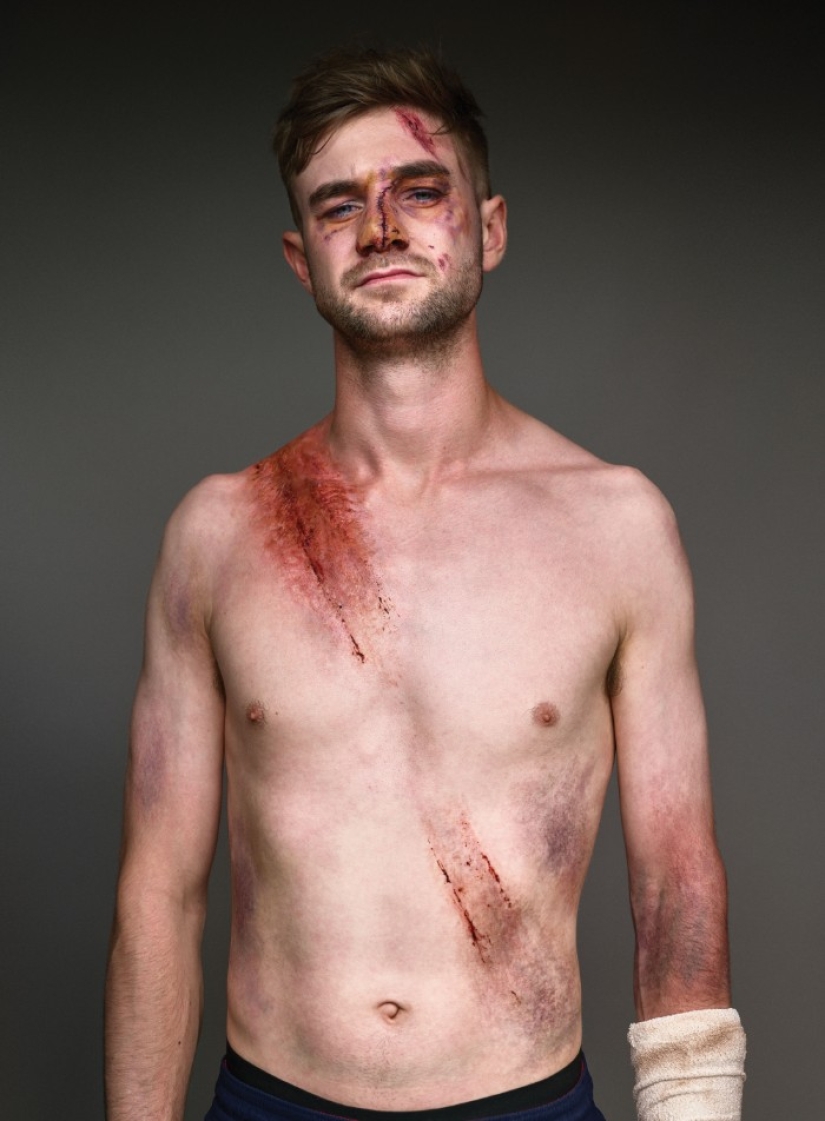 Cinturón de sobrevivientes: 10 magníficas fotos que van a convencer a desgaste