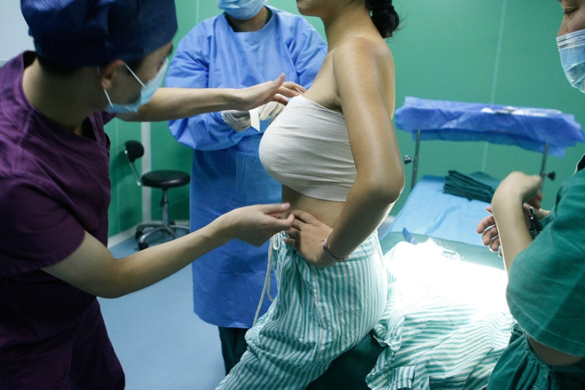 "Cirugía plástica de cenicienta": las japonesas practican el aumento de senos por un día