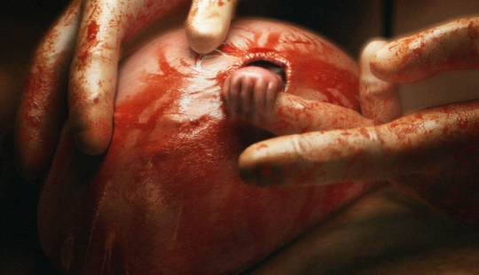 Cómo se ve hoy el niño de la famosa foto "La mano de la esperanza"