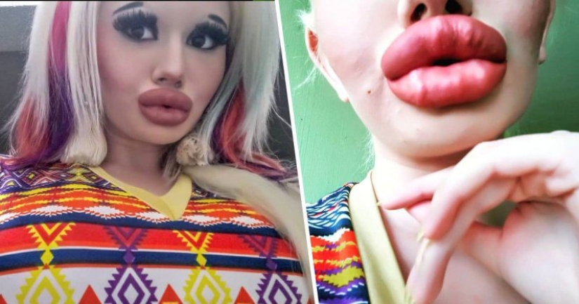 Craving for the beautiful: Bulgarian student enlarges her lips and can't stop