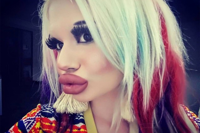 Craving for the beautiful: Bulgarian student enlarges her lips and can't stop