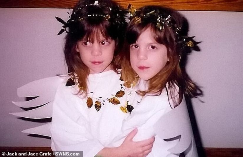 Cuando eran niñas, se convirtieron en niños: las hermanas gemelas cambiaron de género y ahora son realmente felices