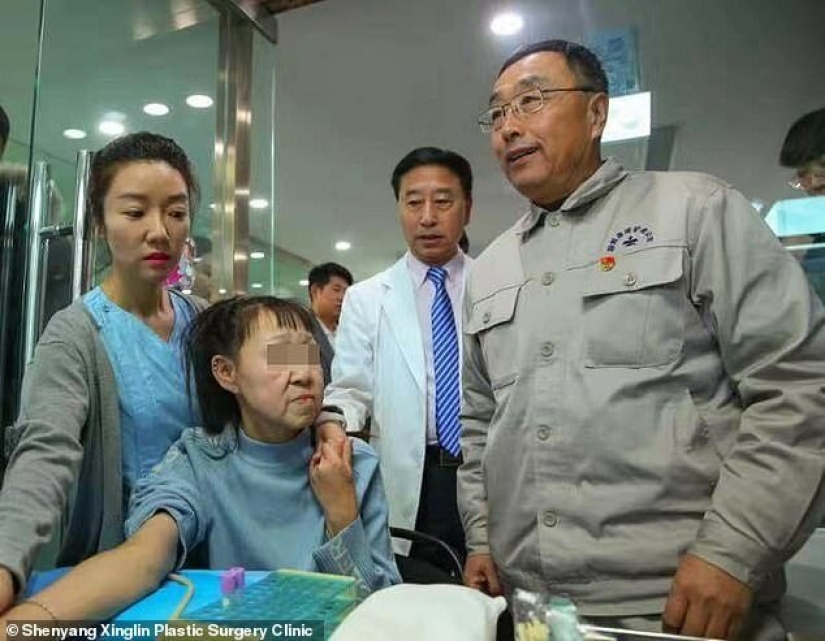 De abuela a niña: una mujer china de 15 años con rostro de anciana se sometió a una cirugía