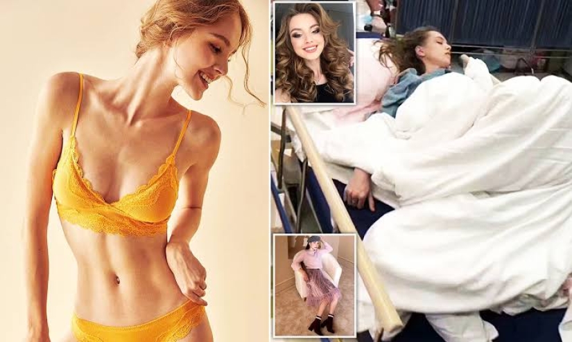 Deadly fashion show: Russian model almost died of meningitis in China