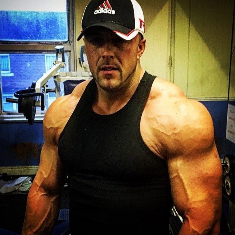 Death from steroids: 37-year-old bodybuilder died from the use of dangerous drugs