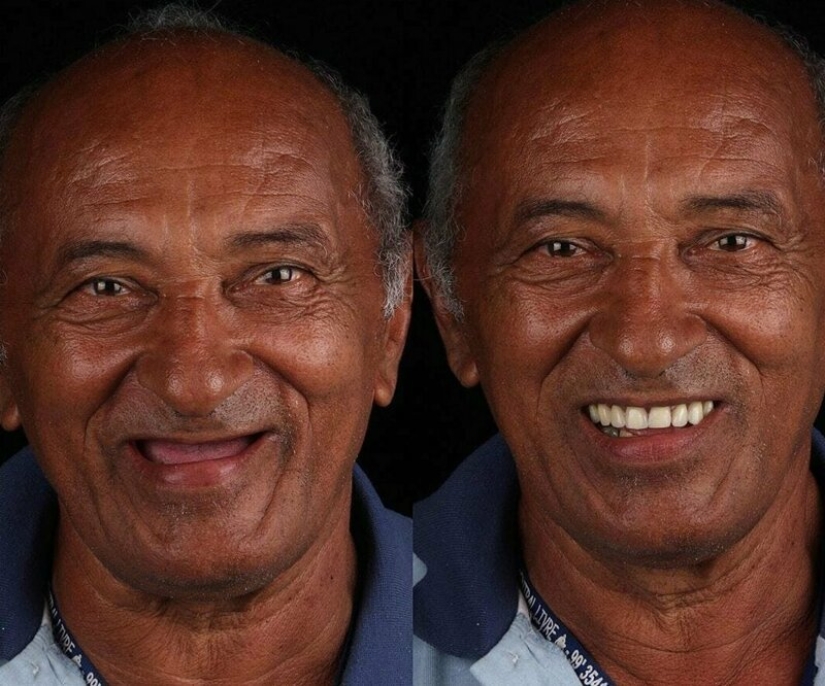 Dentista brasileño ayuda a los pobres a brillar con una sonrisa blanca como la nieve
