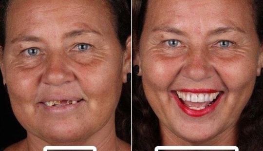 Dentista brasileño ayuda a los pobres a brillar con una sonrisa blanca como la nieve Dentista brasileño ayuda a los pobres a brillar con una sonrisa blanca como la nieve