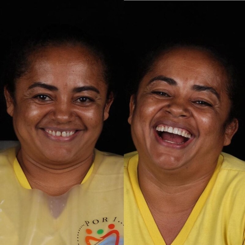 Dentista brasileño ayuda a los pobres a brillar con una sonrisa blanca como la nieve