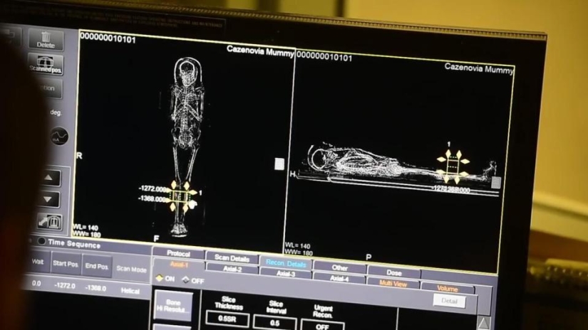 Descubren cáncer en momia egipcia 2.000 años después de su muerte