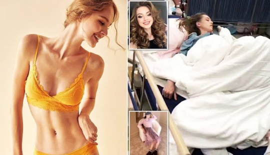 Desfile de moda mortal: modelo rusa casi muere de meningitis en China