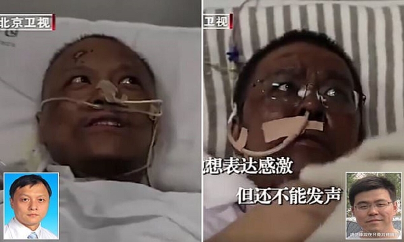 Después del tratamiento para el coronavirus, los médicos de Wuhan se volvieron de piel oscura