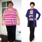 Do not envy the "before and after" pictures: the sharply dropped kilograms can return with a vengeance