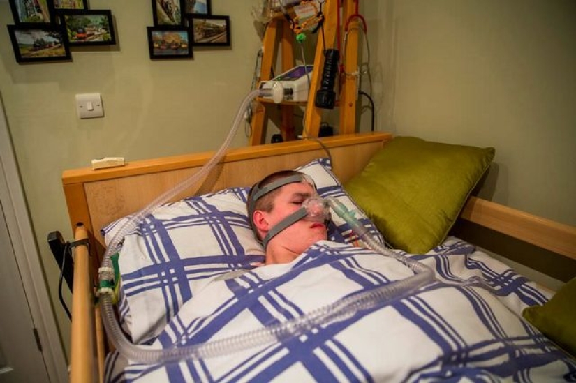 Do not sleep — you will die: a teenager suffers from the rare "Curse of Undine" syndrome