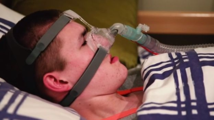 Do not sleep — you will die: a teenager suffers from the rare "Curse of Undine" syndrome