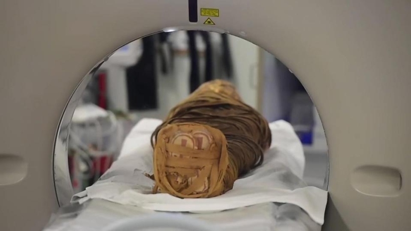 Doctors found cancer in Egyptian mummy 2,000 years after death