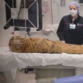 Doctors found cancer in Egyptian mummy 2,000 years after death