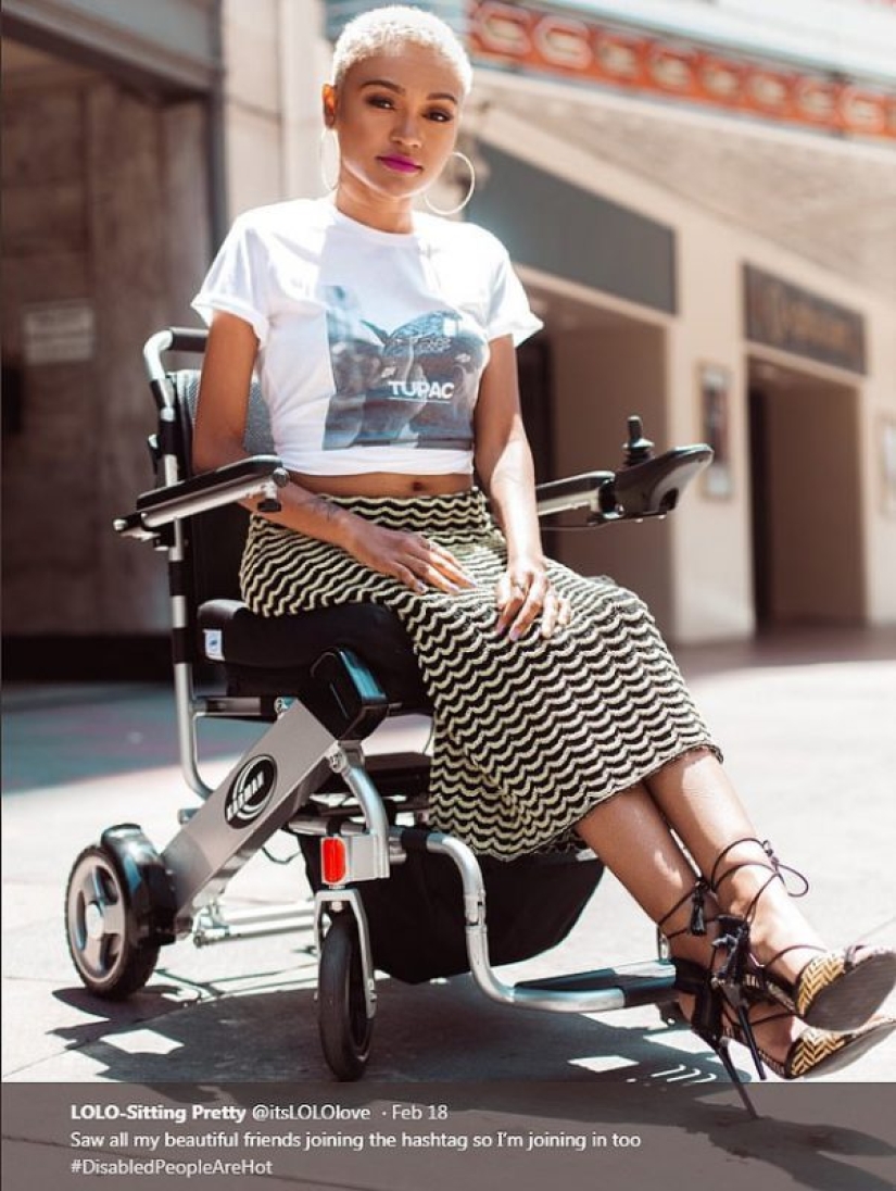 El derecho a la belleza: las personas con discapacidad comparten fotos atractivas en las redes sociales