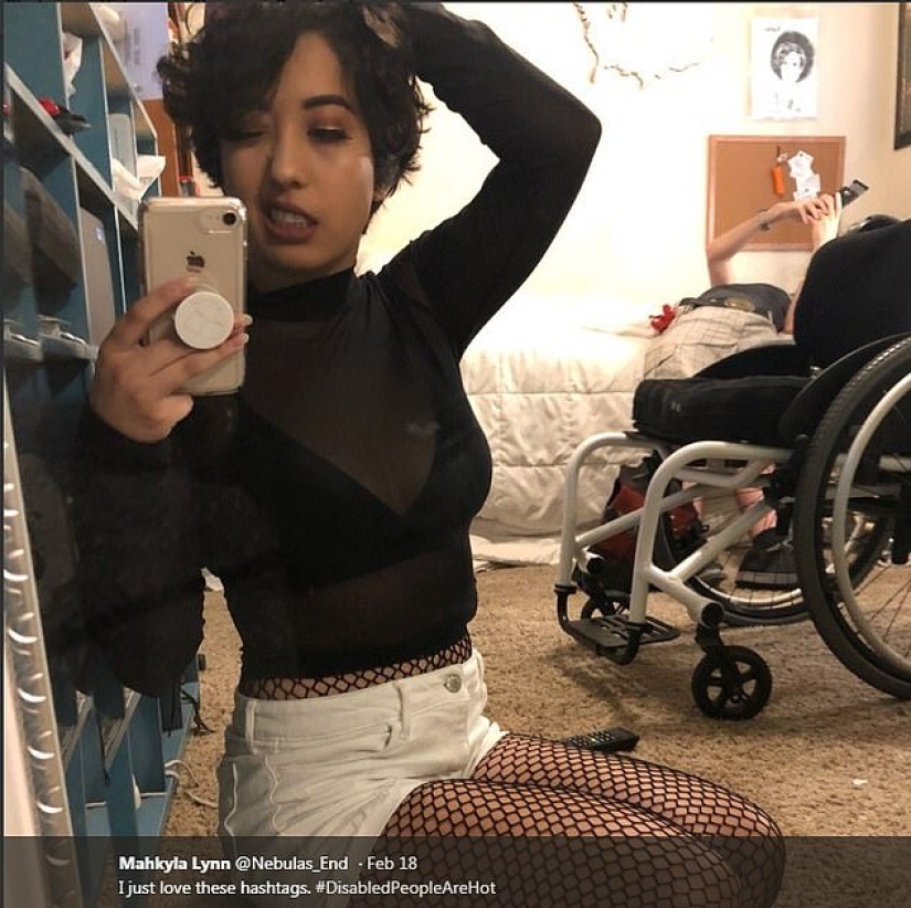 El derecho a la belleza: las personas con discapacidad comparten fotos atractivas en las redes sociales