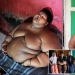 El niño más gordo del mundo, que pesaba 192 kg a la edad de 10 años, perdió más del doble de peso