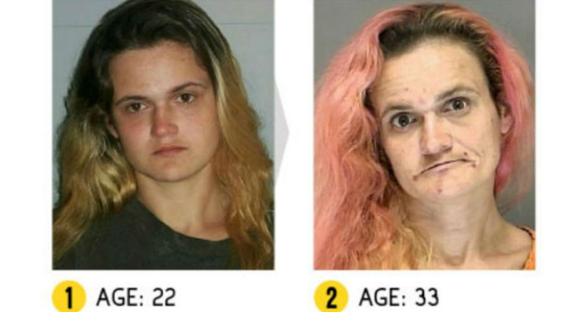 El resultado es obvio: cómo cambia la apariencia de una persona debido a las drogas