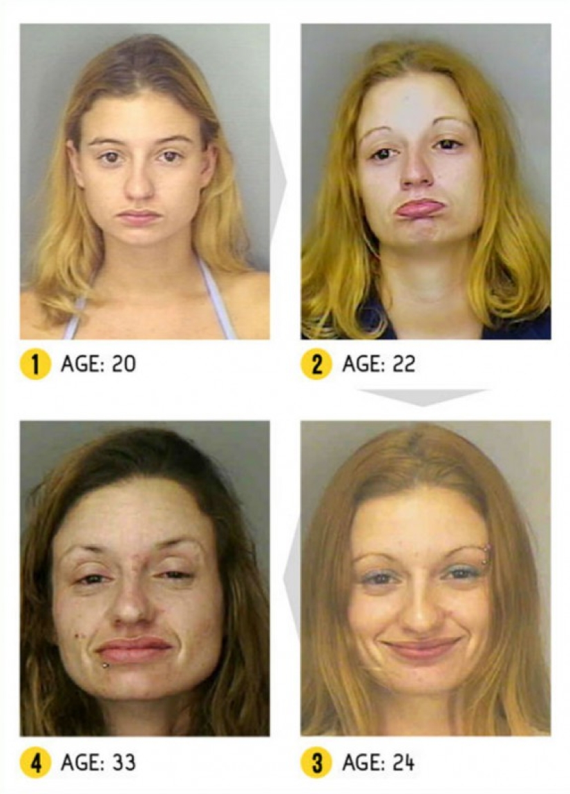 El resultado es obvio: cómo cambia la apariencia de una persona debido a las drogas
